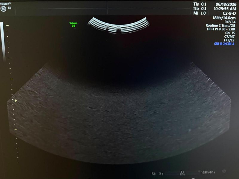 GE C2-9-D Probe REF: 5405253 YOM: 2019