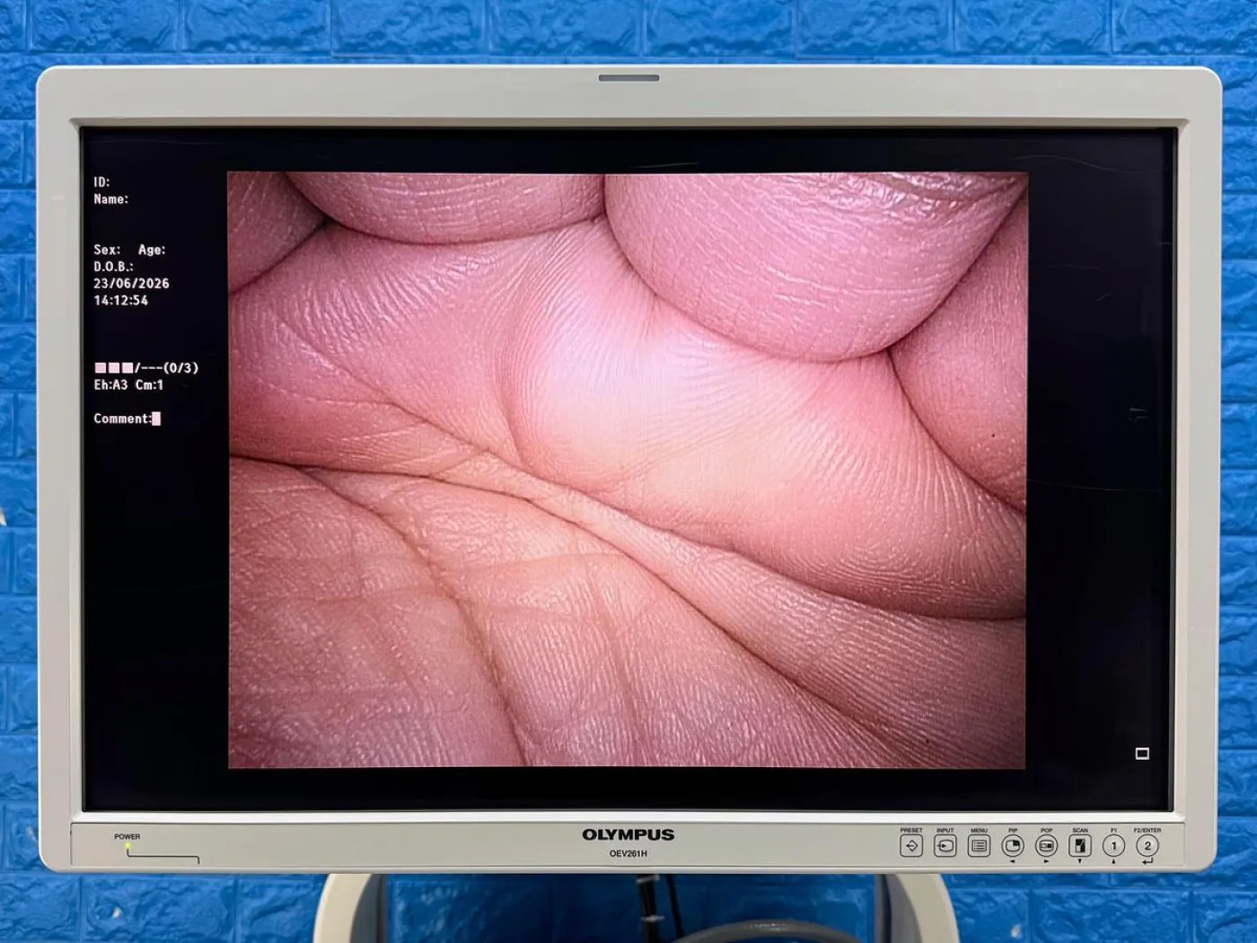 Olympus WA50010A EndoEye II HD Video Laparoscope 10mm 0 Degree REF: WA50010A - 3