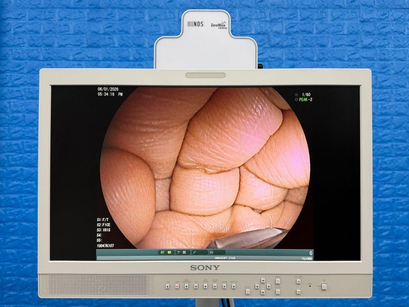 Fujinon Scope EG-580 UT Linear Ultrasonic Endoscope
