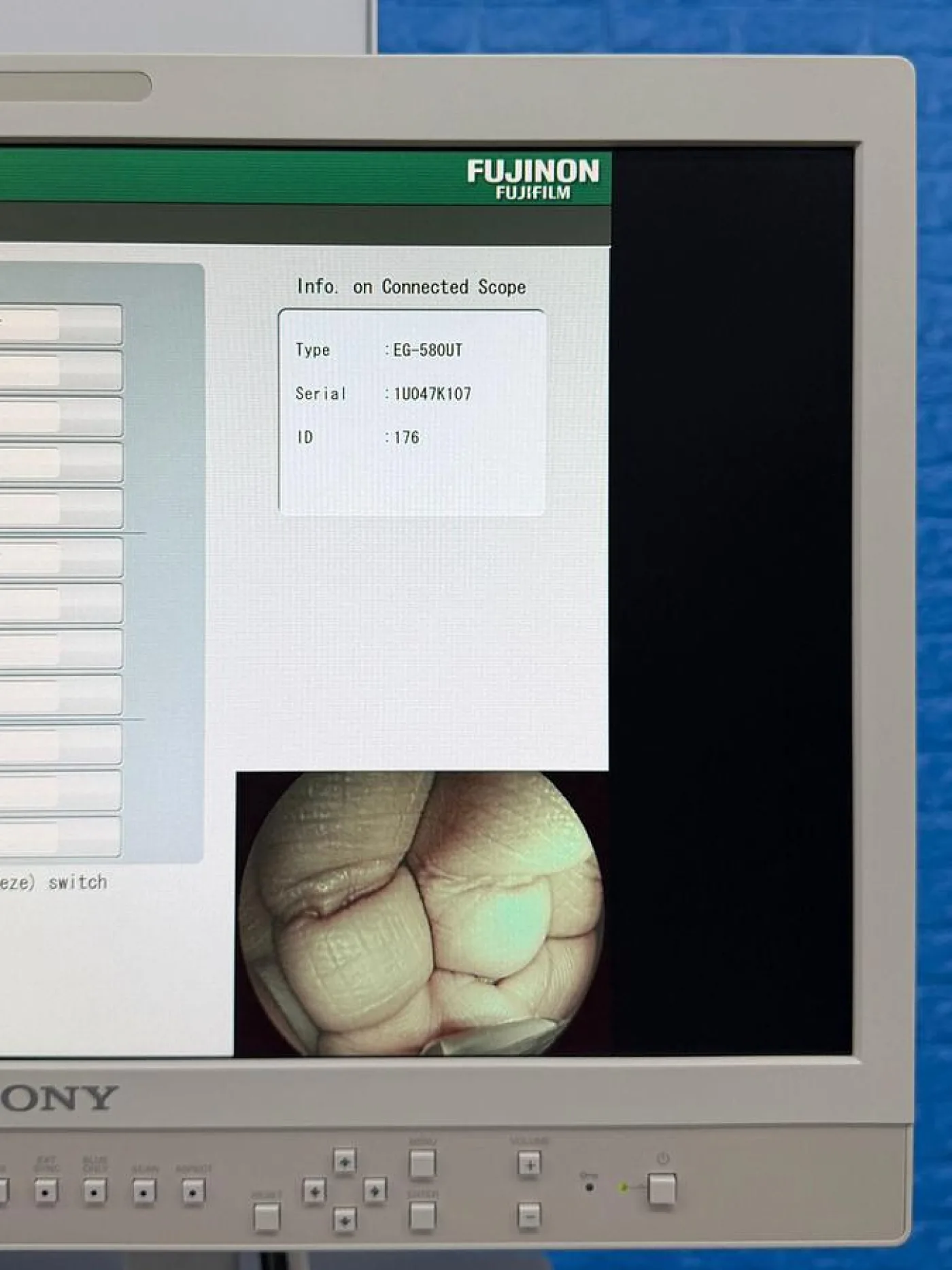 Fujinon Scope EG-580 UT Linear Ultrasonic Endoscope - 4