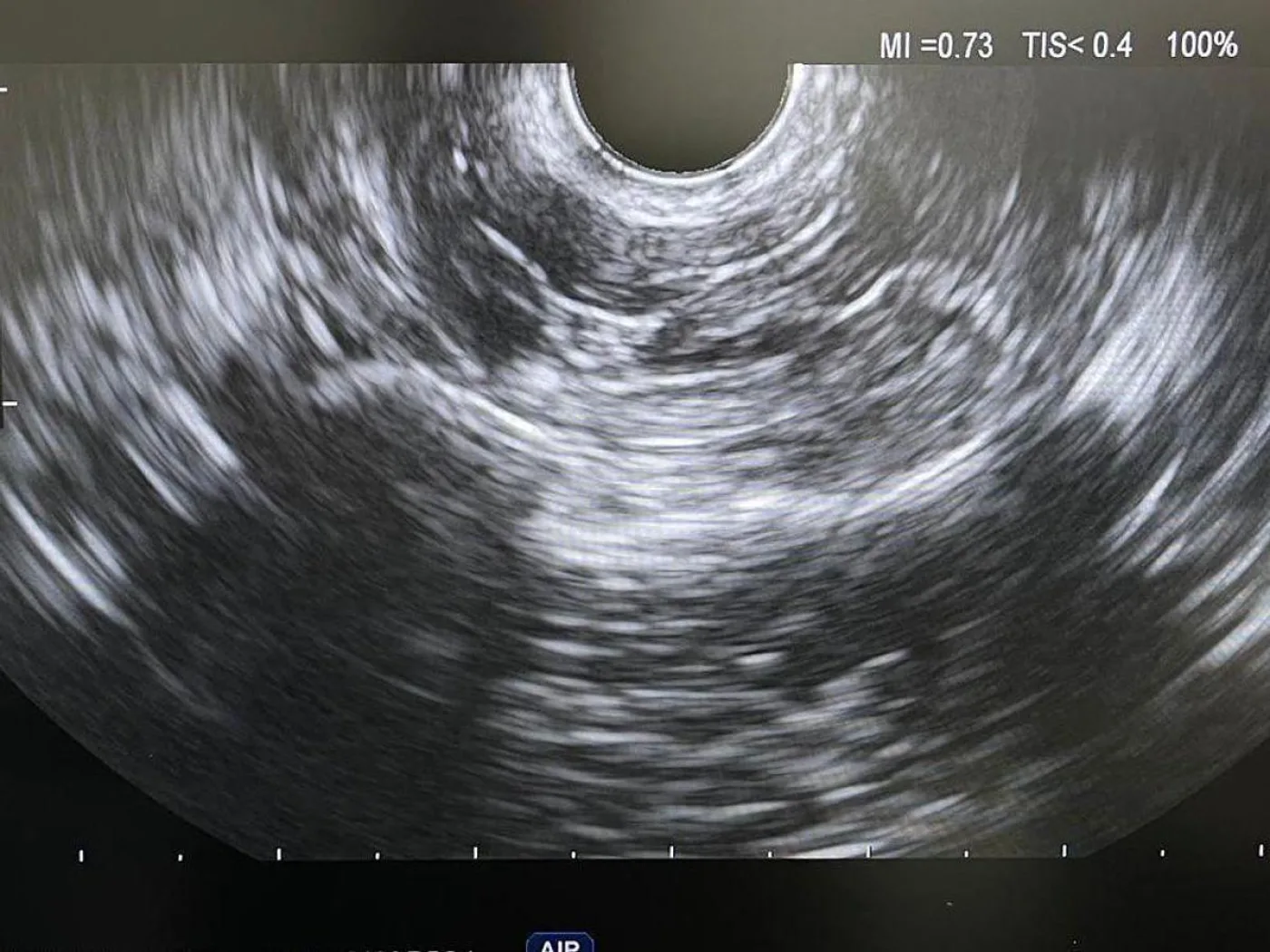 OLYMPUS EU-ME1 Endoscopy Ultrasound Processor - Power Input Voltage: 110 - 7