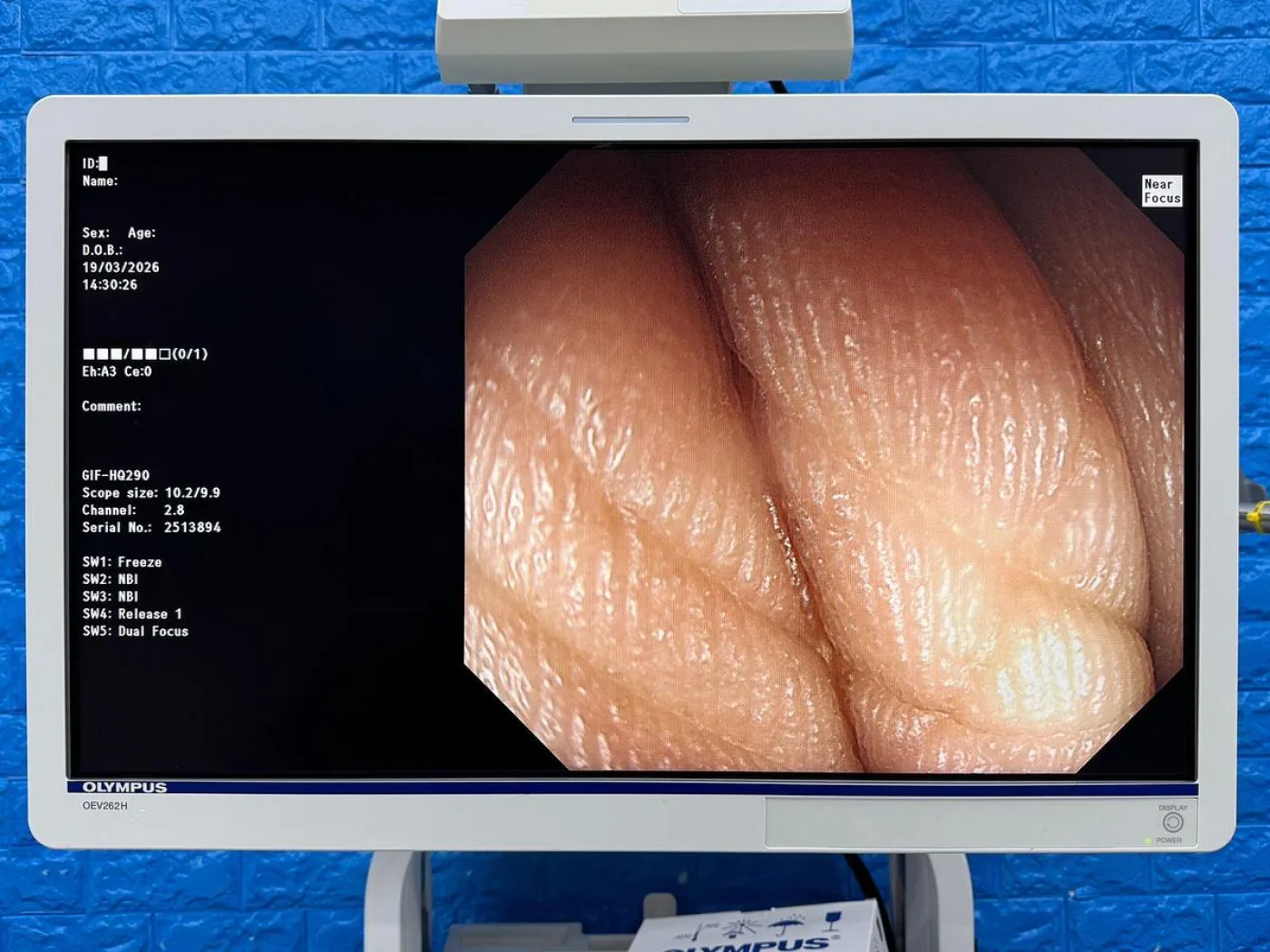 Olympus Scope GIF-HQ290 - 2
