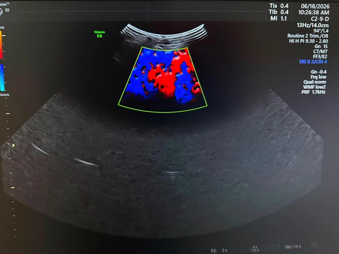 GE C2-9-D Probe REF: 5405253 YOM: 2019 - 2