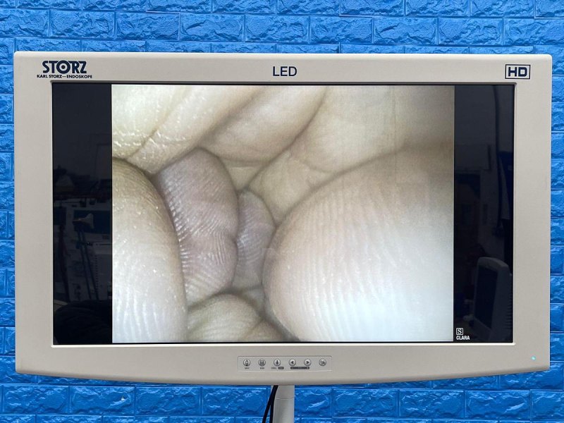 Karl Storz 13925 PKS Colonoscope