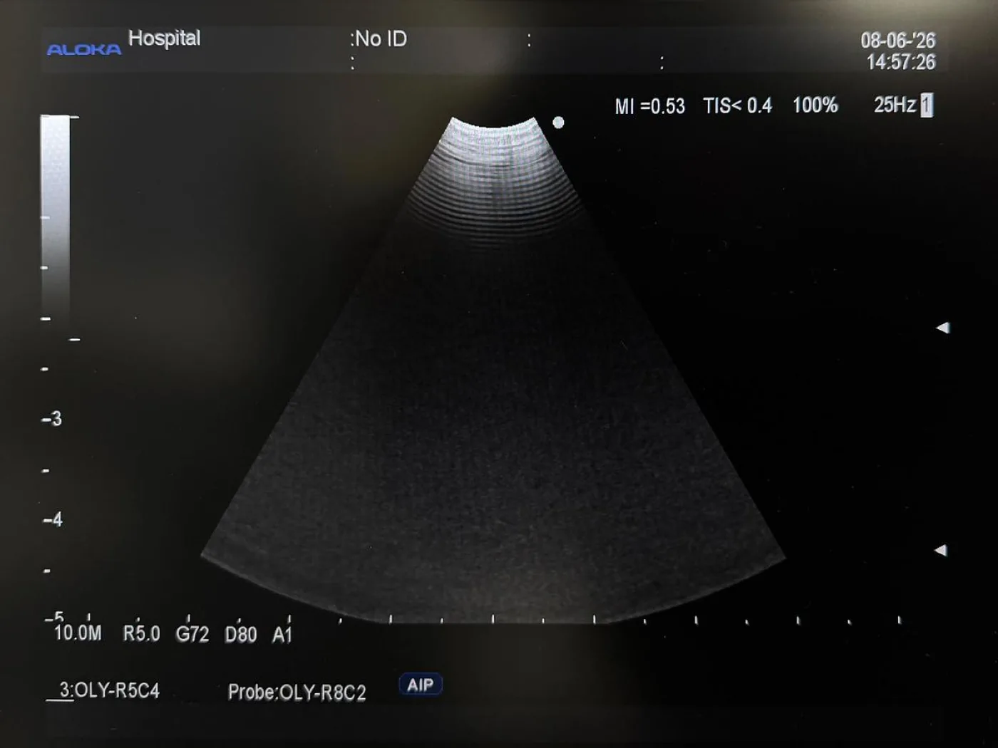 Olympus BF-UC260FW Linear Ultrasound Bronchoscope EBUS - 7