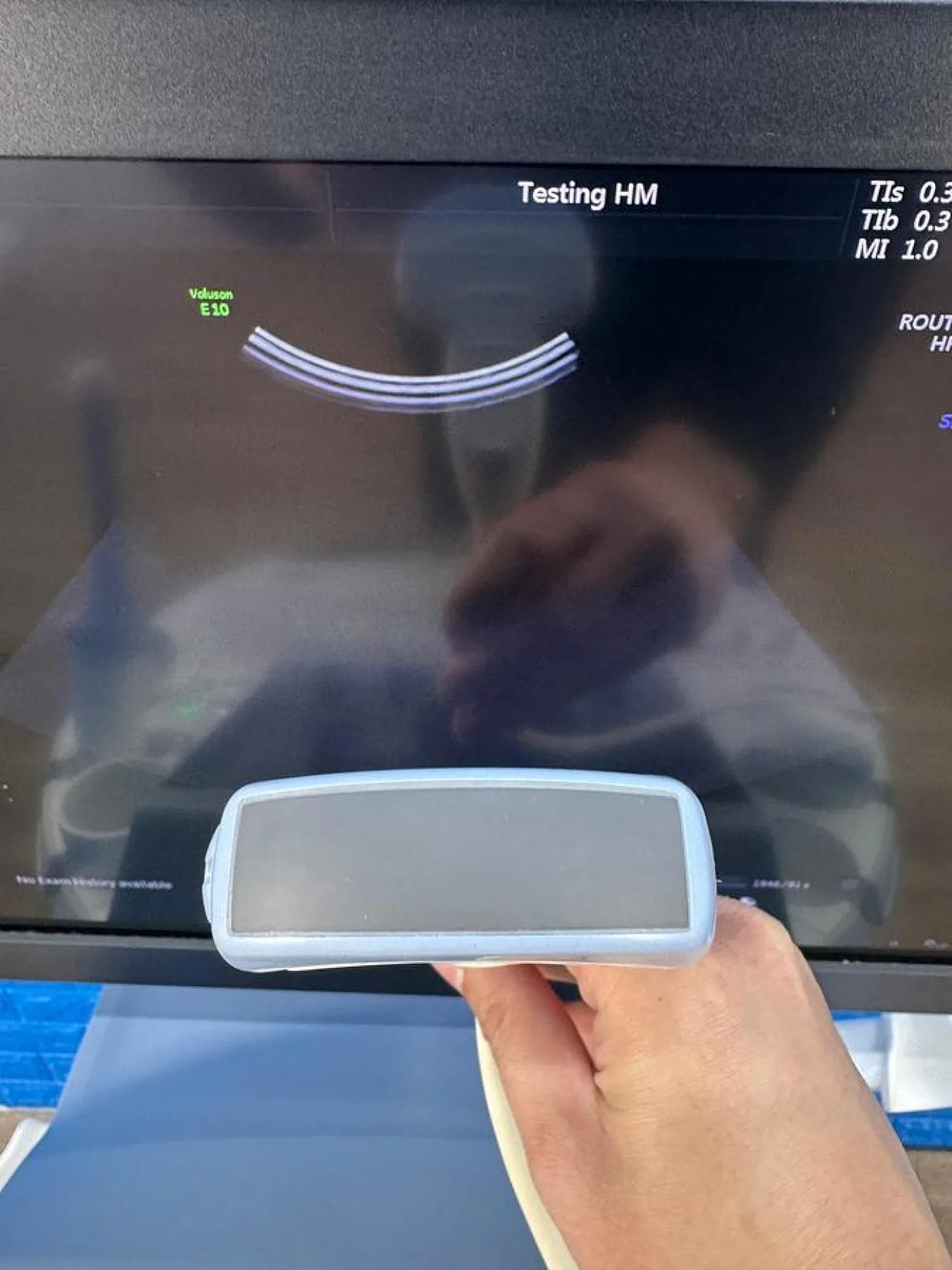For Sale GE Voluson E10 BT17 Ultrasound System (2017) OLED | 4D OB/GYN Ultrasound - 8