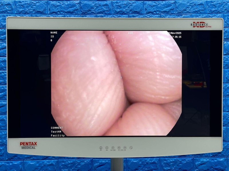 Pentax Scope Model: ECY-1575K YOM: 2020 Cystoscope, 23 Times Used.