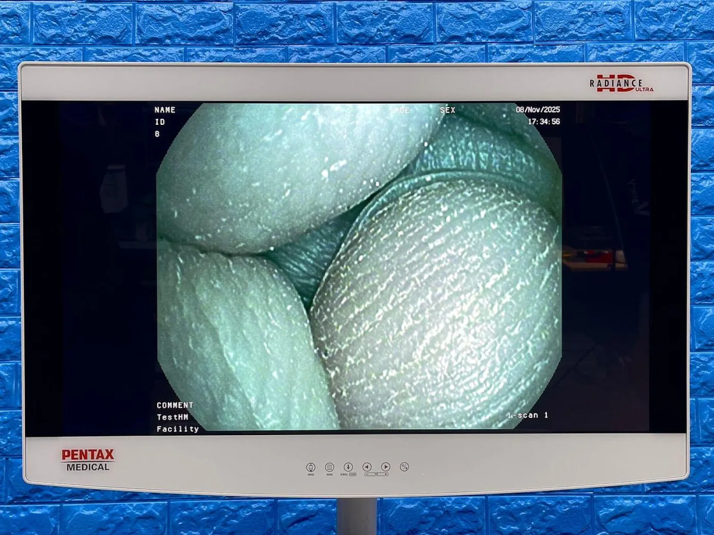 Pentax Scope Model: ECY-1575K YOM: 2020 Cystoscope, 23 Times Used. - 3