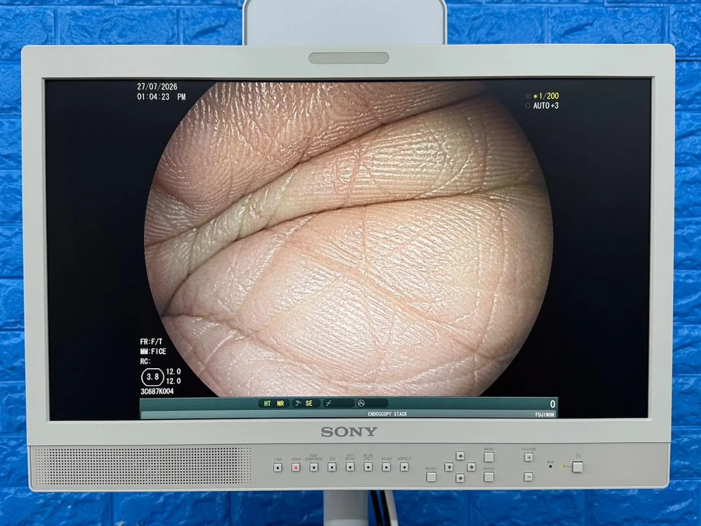 Fujinon Scope Model: EC-600WM - 1