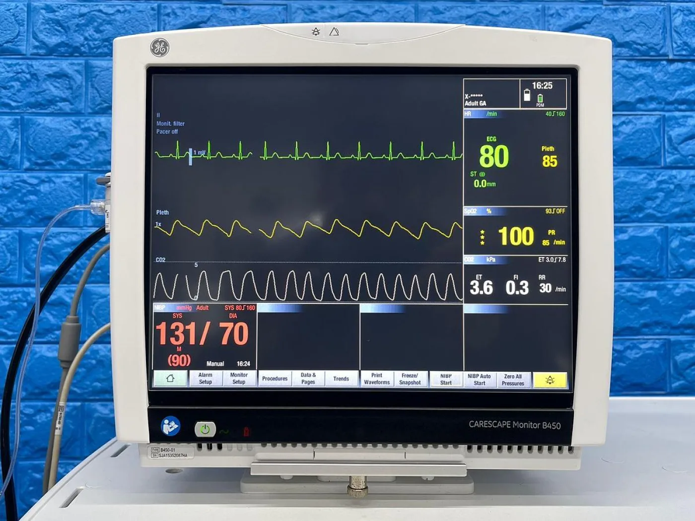 GE Datex-Ohmeda Aespire View YOM: 2015 REF: 1009-9212-000 - 8
