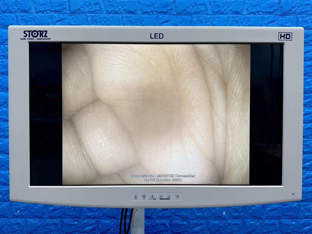 Karl Storz 13924 PKS Colonoscope