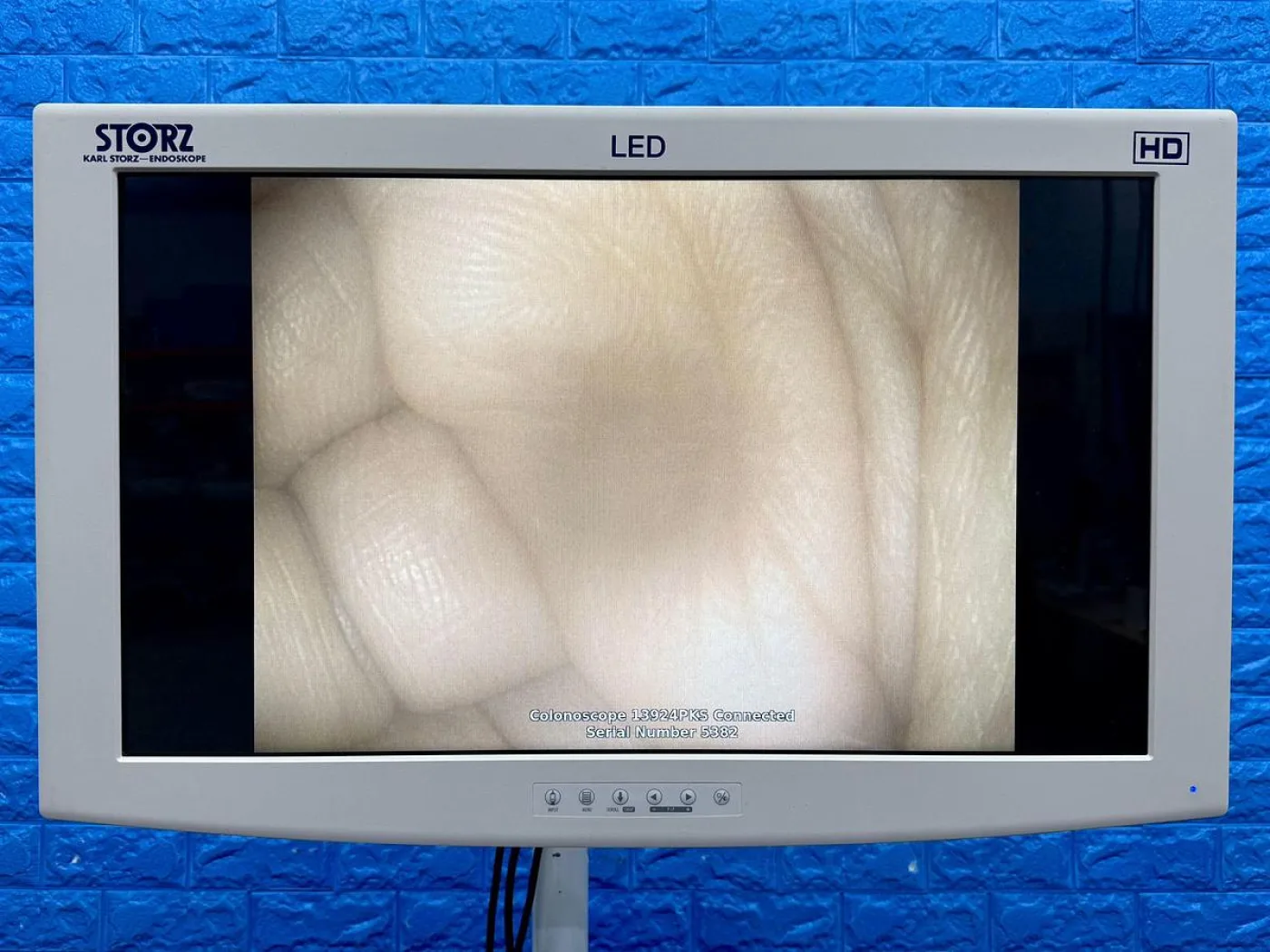 Karl Storz 13924 PKS Colonoscope - 1