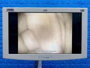 Karl Storz 13924 PKS Colonoscope