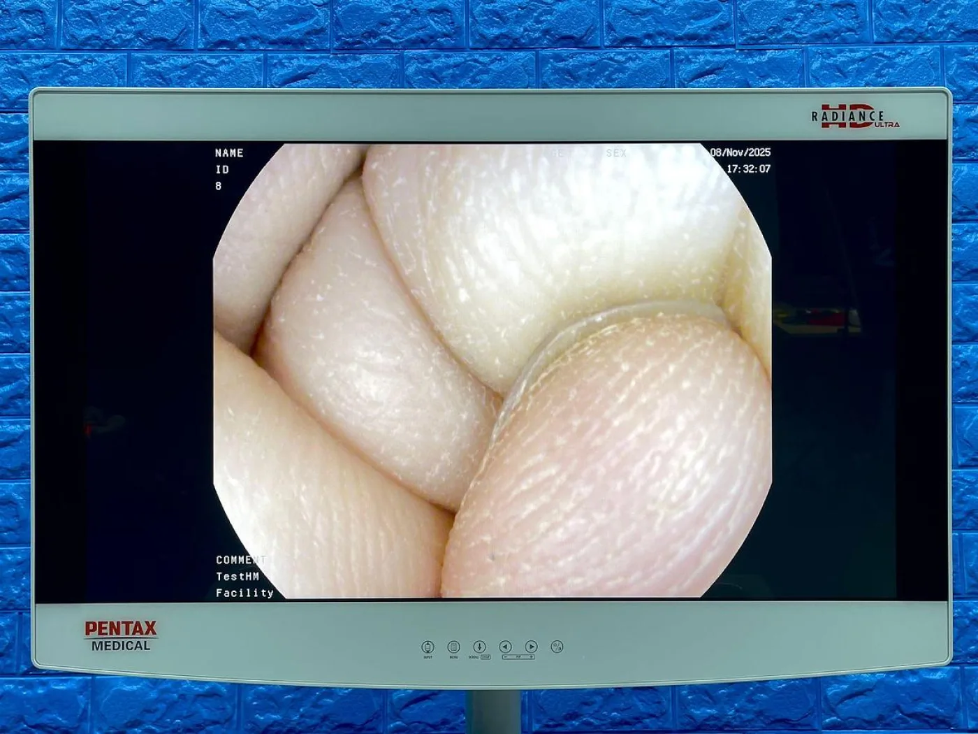 Pentax Scope Model: G-EYE38-i 10NL YOM: 2019 Colonoscope, 36 Times Used. - 2