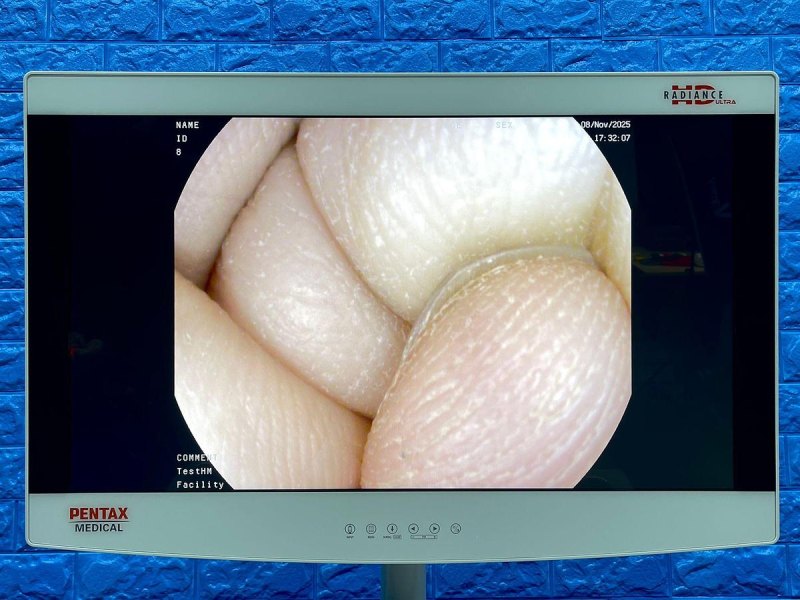 Pentax Scope Model: G-EYE38-i 10NL YOM: 2019 Colonoscope, 36 Times Used.