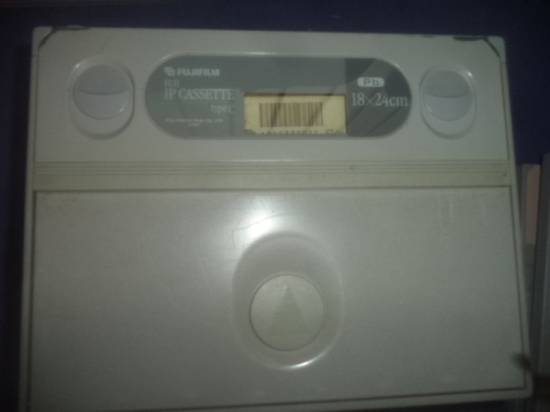 EC-V Lightweight Cassette (Neu)