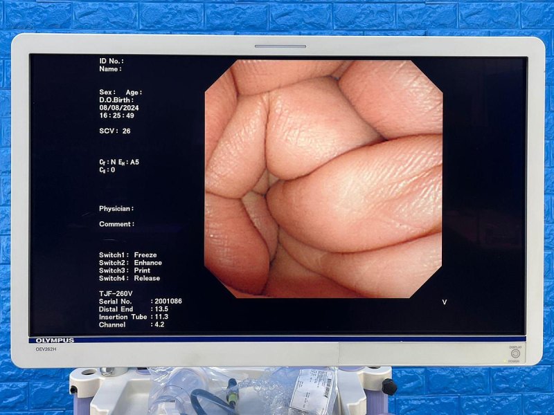 Olympus TJF 260V Duodenoscope