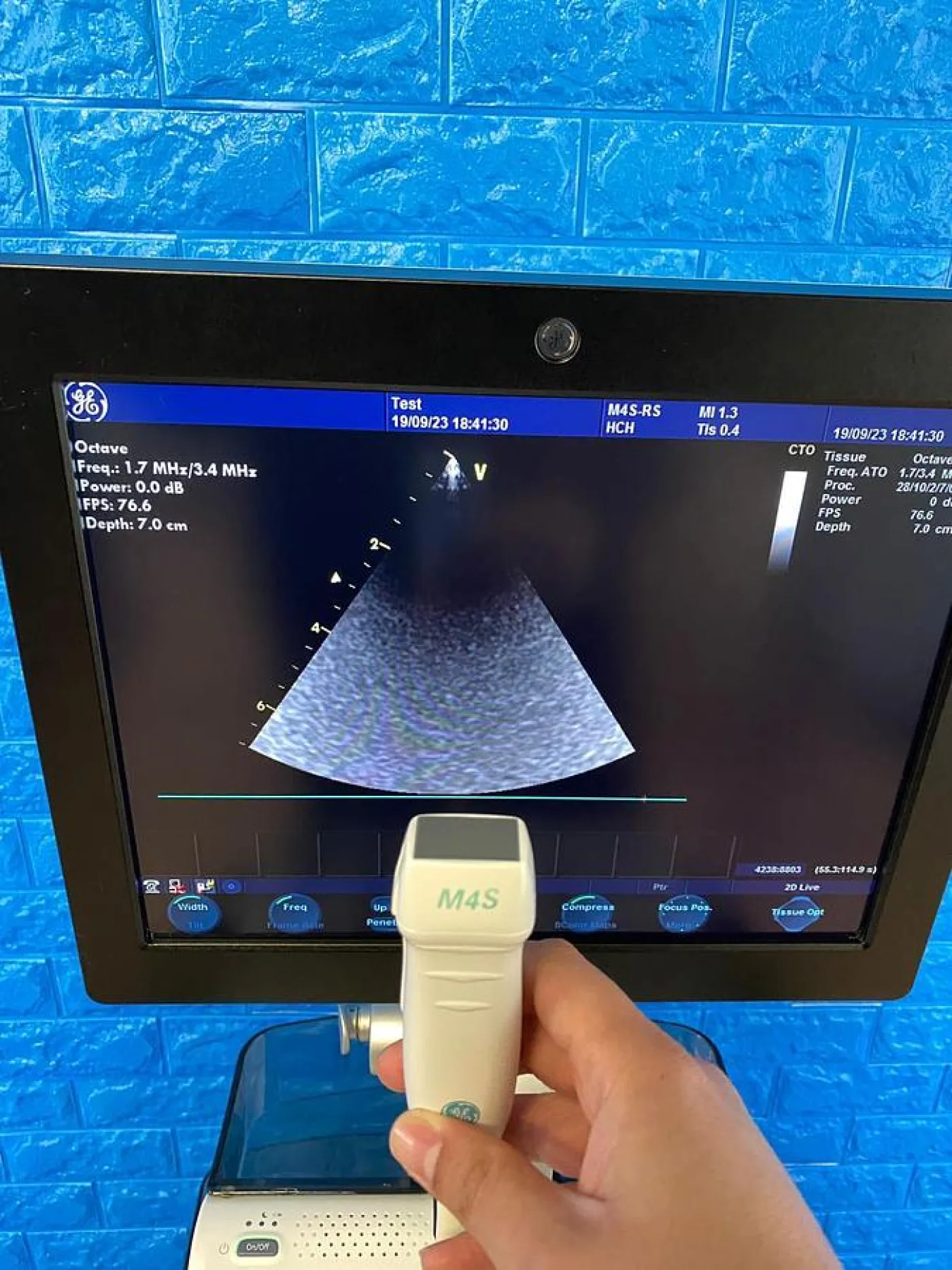 GE Vivid S6 Cardiovascular ultrasound system YOM: 2013 - 6