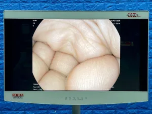 Pentax Scope Model: G-EYE38-i 10NL Colonoscope, YOM: 2019, 26 Times Used.