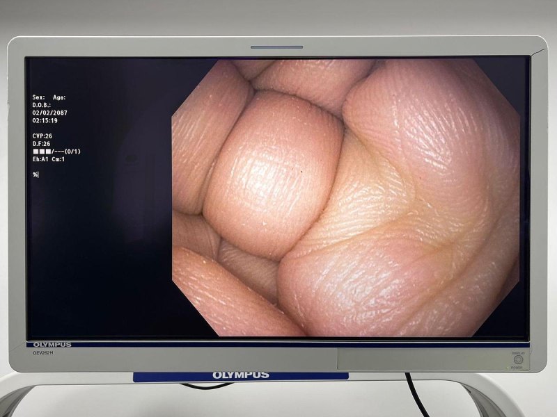 Olympus Scope Model: GIF-H190N
