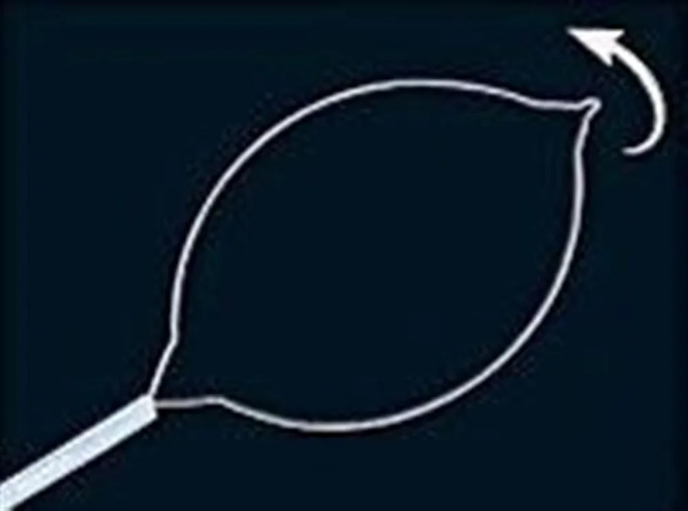 oval electrosurgical snare - 1600 X 1.8 MM