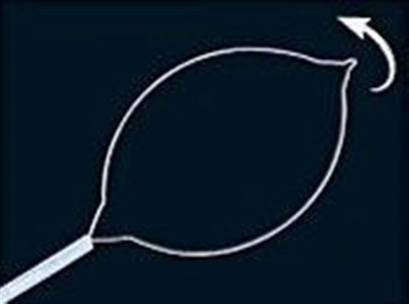 oval electrosurgical snare - 1600 X 1.8 MM