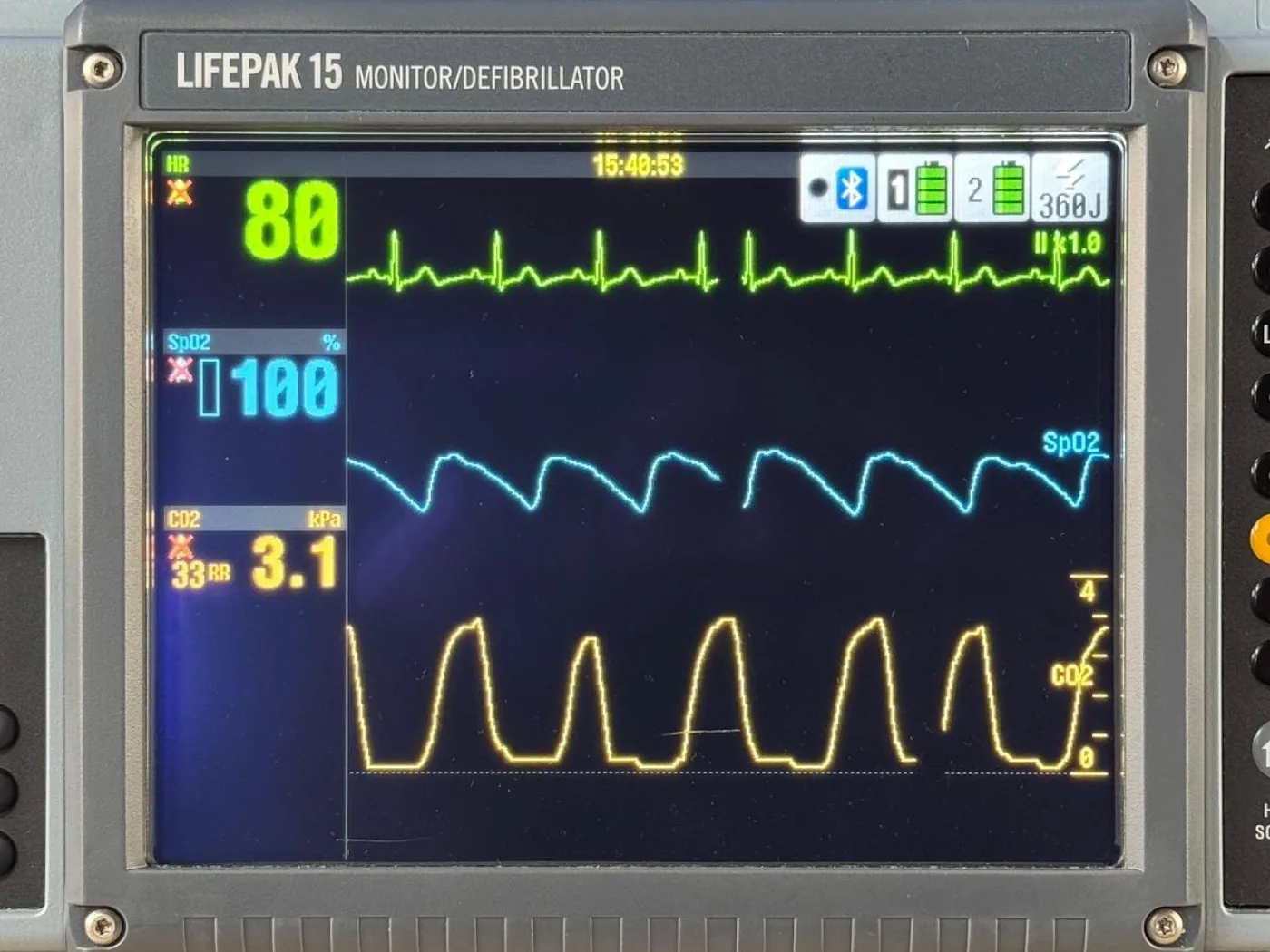 Physio Control Lifepak 15 Defibrillator REF: 99577-001418 YOM: 2022 - 6