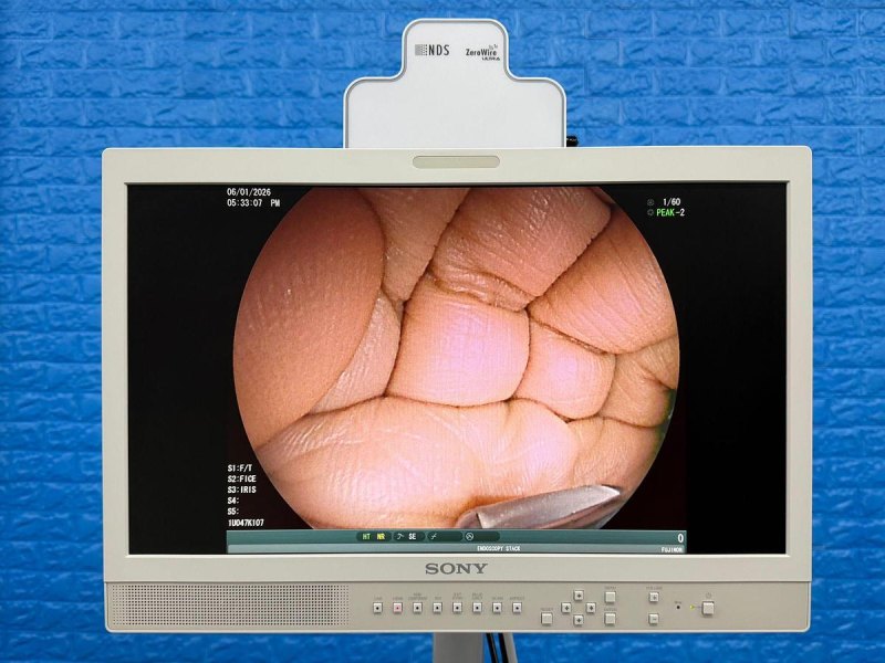 Fujinon Scope EG-580 UT Linear Ultrasonic Endoscope