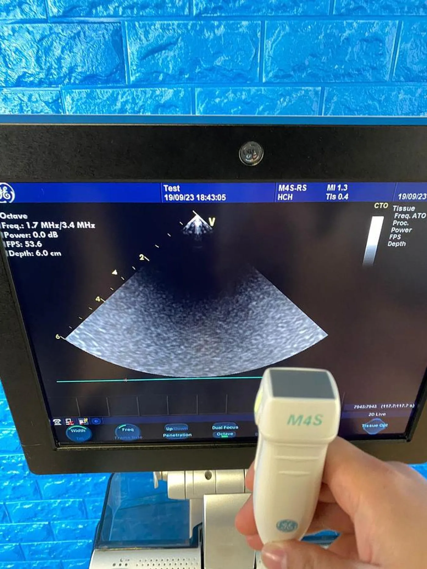GE Vivid S6 Cardiovascular ultrasound system YOM: 2013 - 8