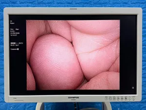 Olympus WA50010A EndoEye II HD Video Laparoscope 10mm 0 Degree REF: WA50010A