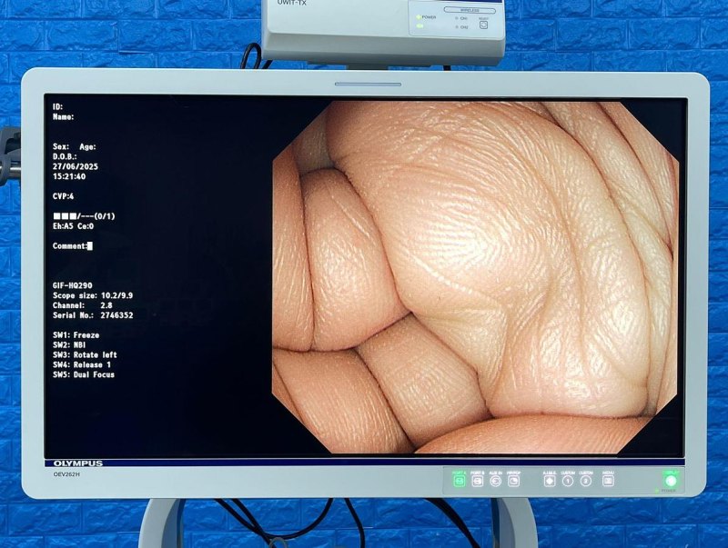 Olympus GIF-HQ290 Gastroscope