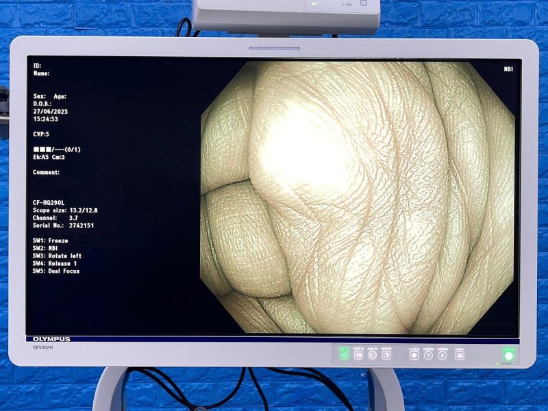 Olympus CF-HQ290L Colonoscope