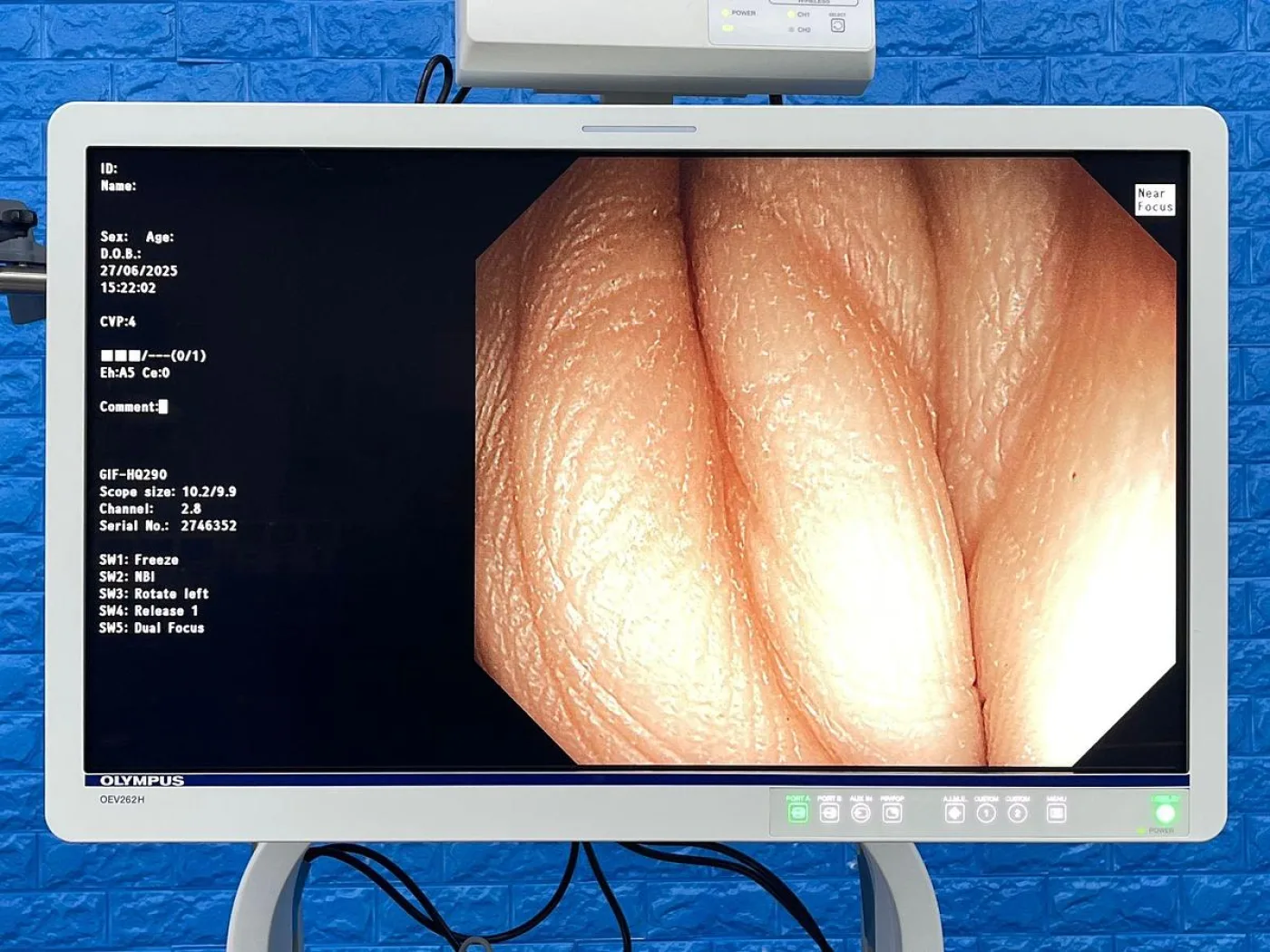 Olympus GIF-HQ290 Gastroscope - 5