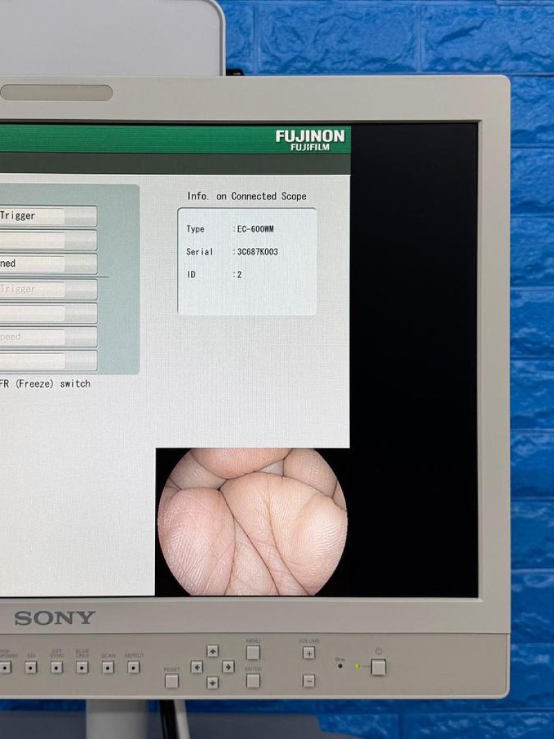 Fujinon Scope Model: EC-600WM