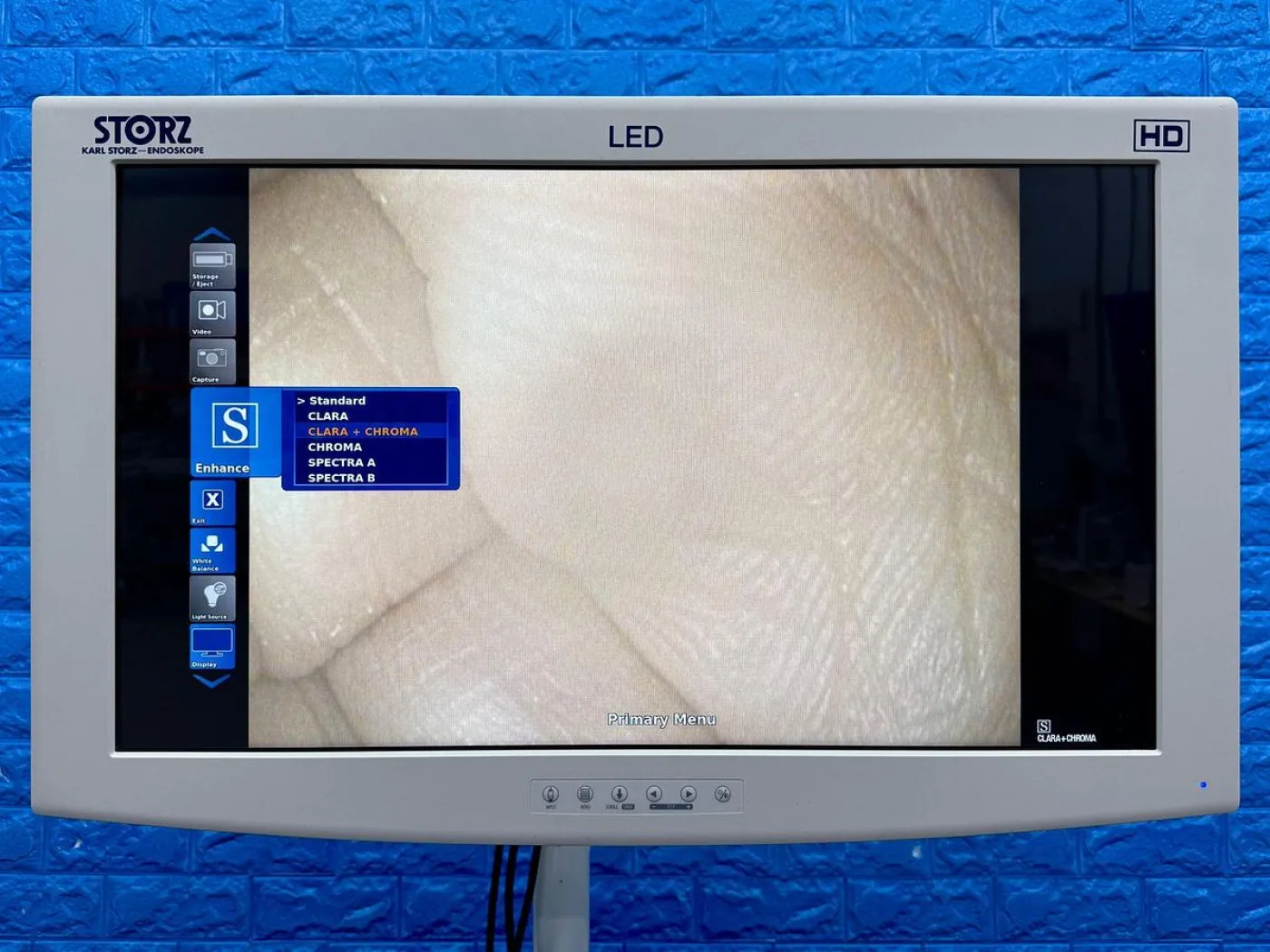 Karl Storz 13924 PKS Colonoscope - 5