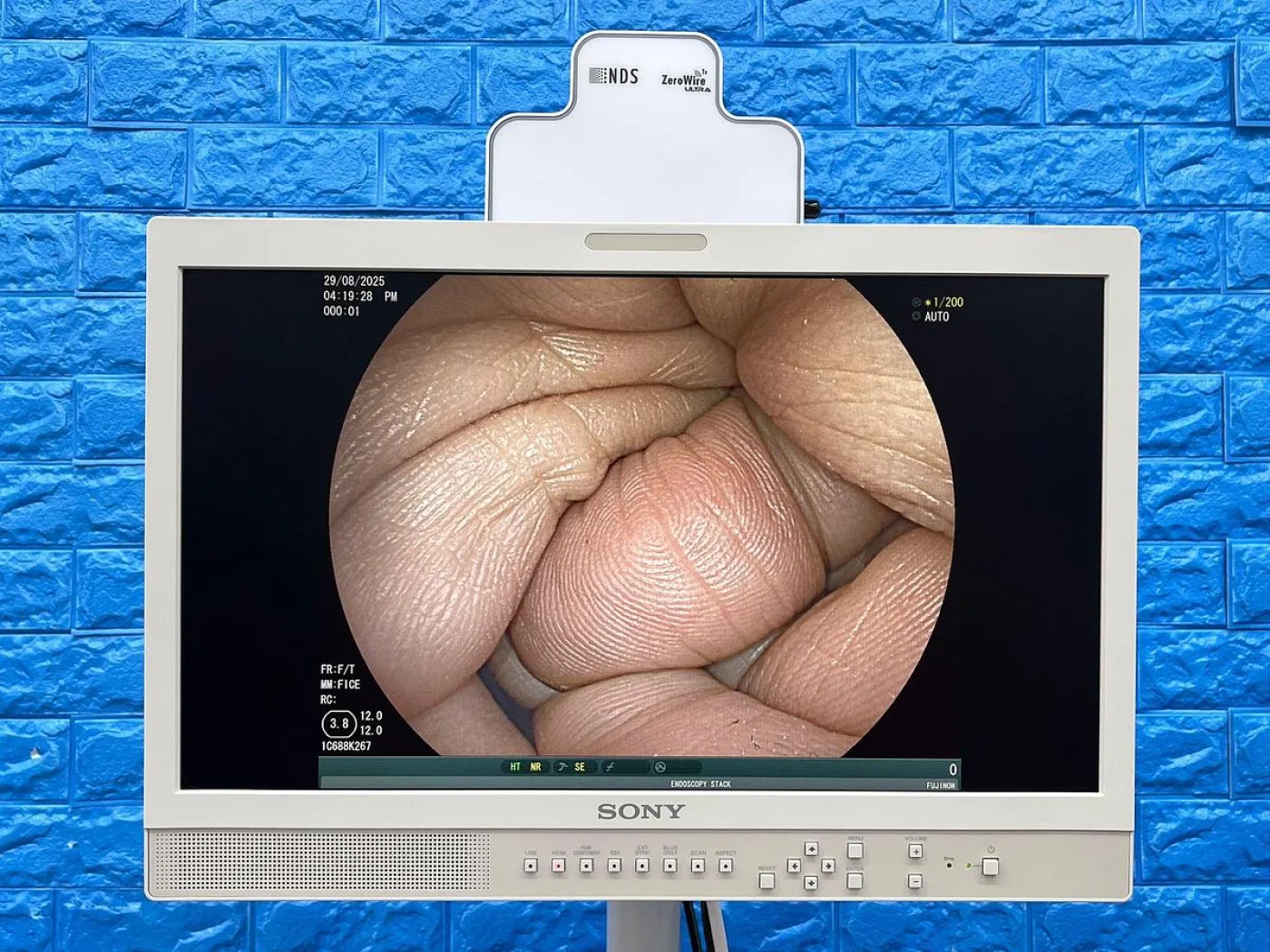 Fujinon VP-3500HD System with XL-4450 Light source Endoscopy System - 5