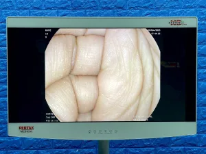 Pentax Scope Model: G-EYE38-i 10NL, Colonoscope, YOM: 2019, 25 Times Used.