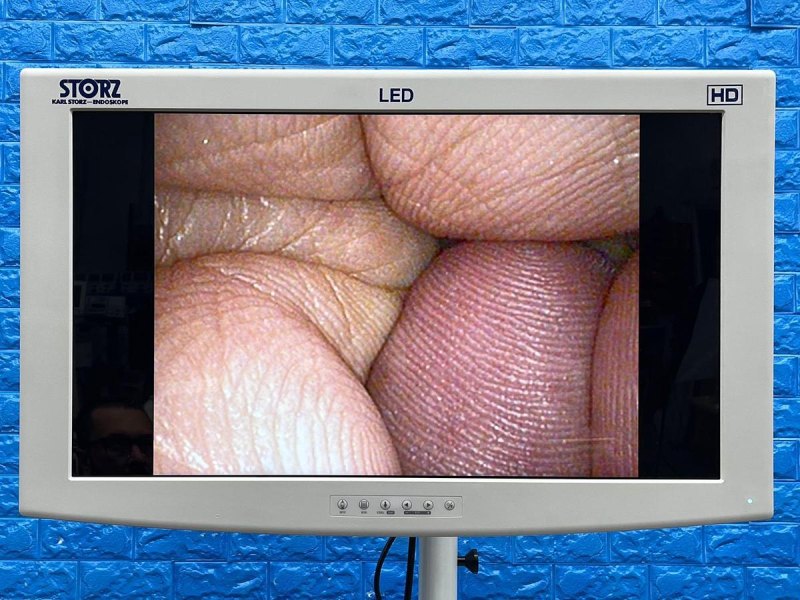 Karl Storz 11272 VN Cysto-Urethroscope