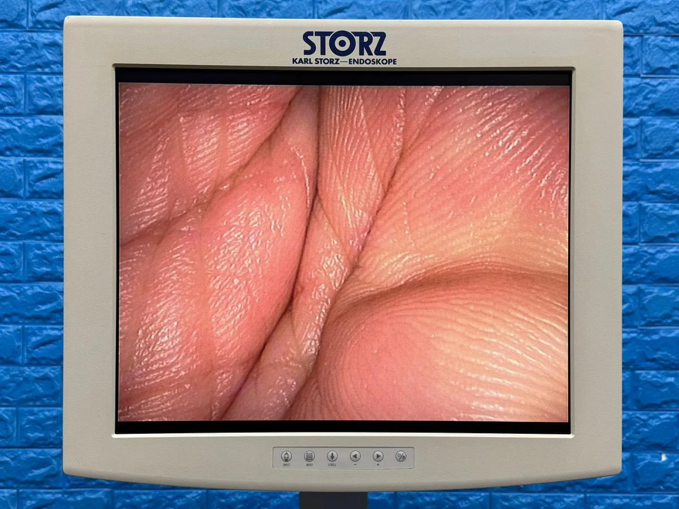 Karl Storz Image 1 Hub with S3 Camera head Laparoscopy Tower - 7