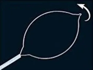 oval electrosurgical snare - 1800 X 1.8 MM