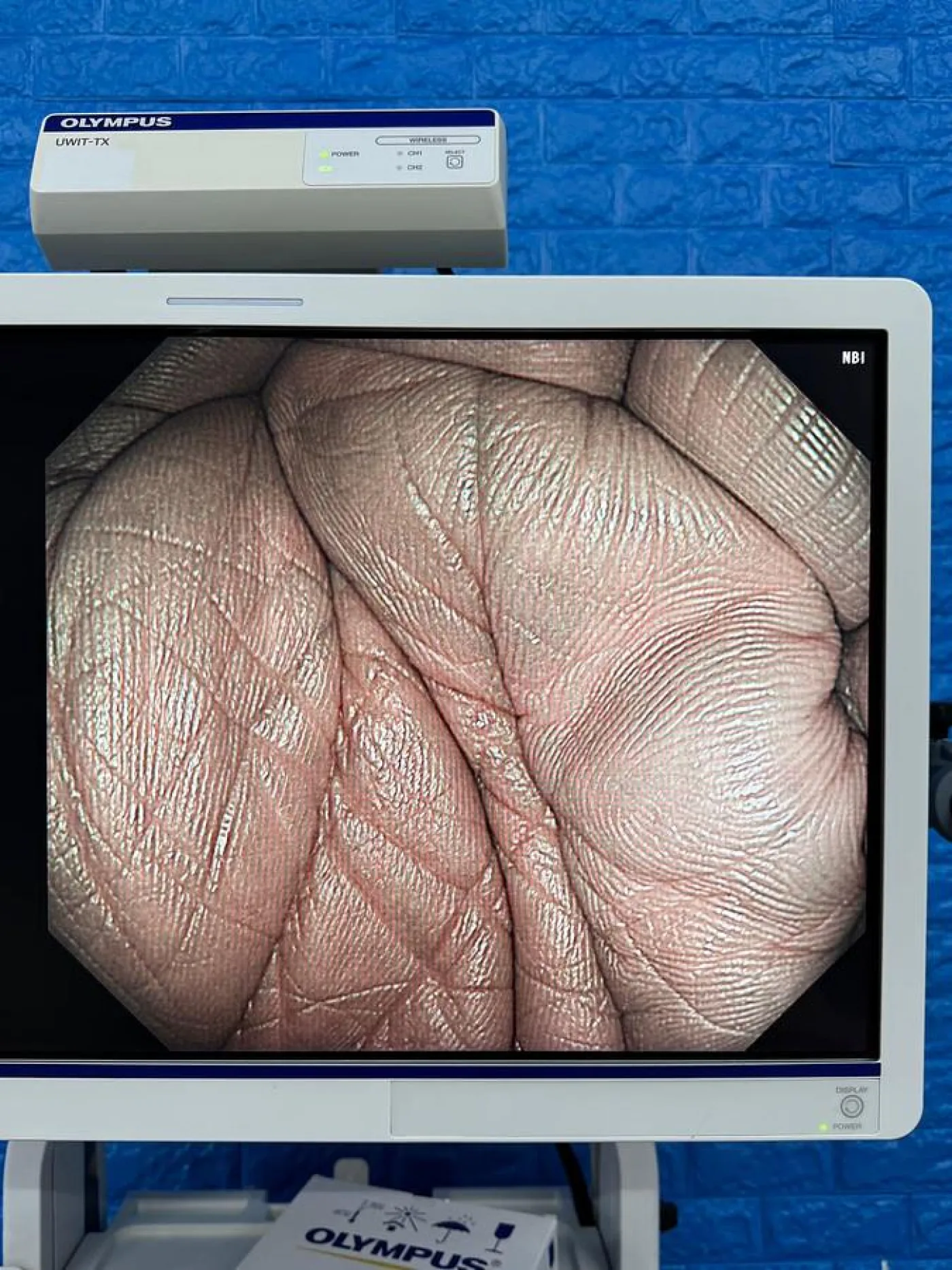 Olympus Scope Model: GIF-HQ290 Gastroscope - 3