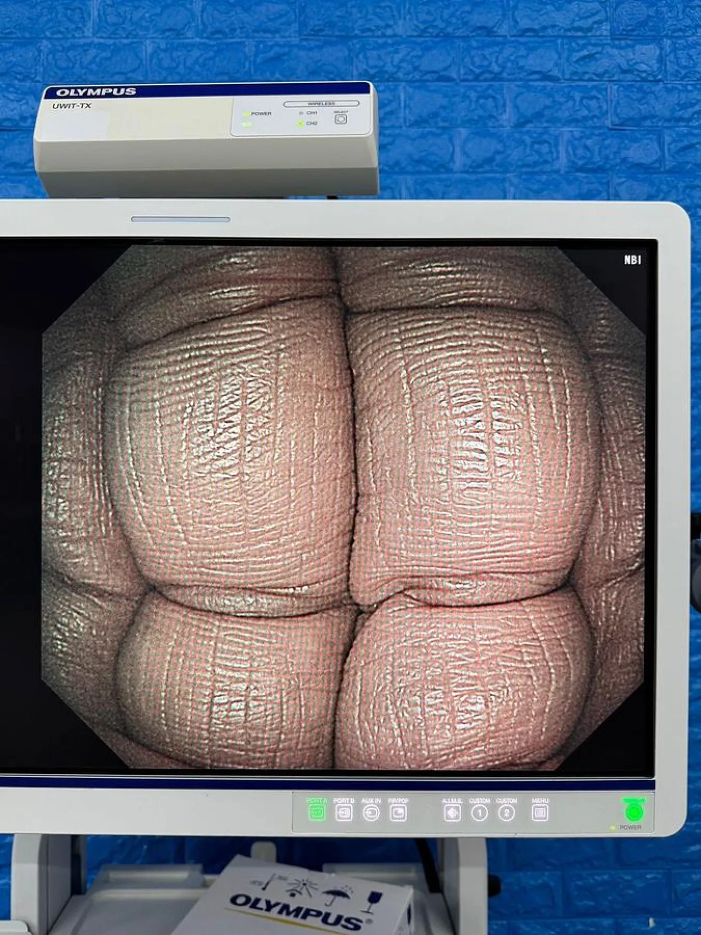 Olympus Scope Model GIF HQ290 Gastroscope - 3