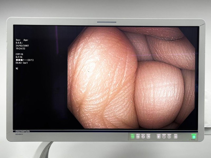 Olympus PCF-H190DL Colonoscopes