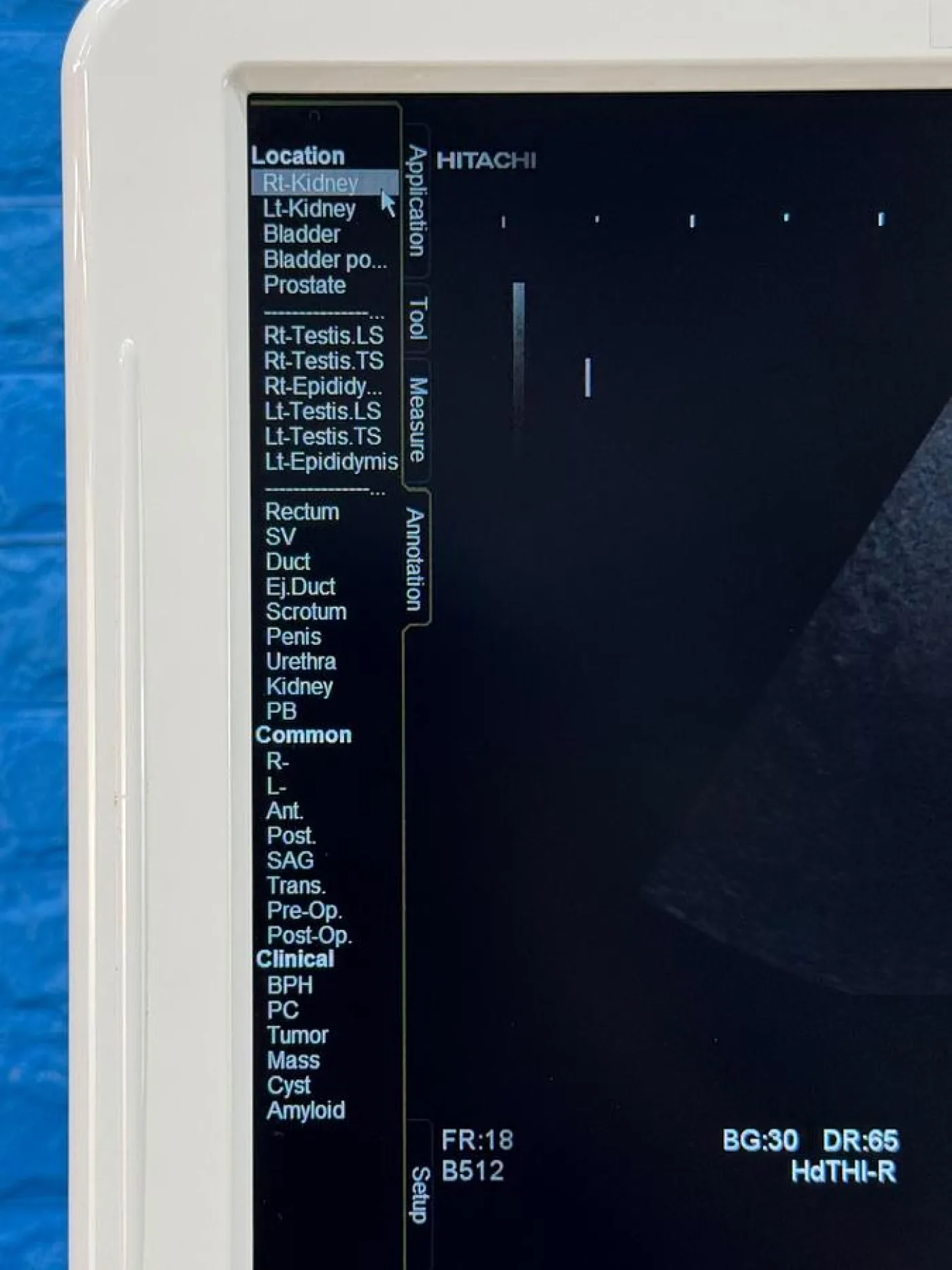 Hitachi HI Vision Avius Ultrasound REF HI Vision Avius YOM: 2018 - 8