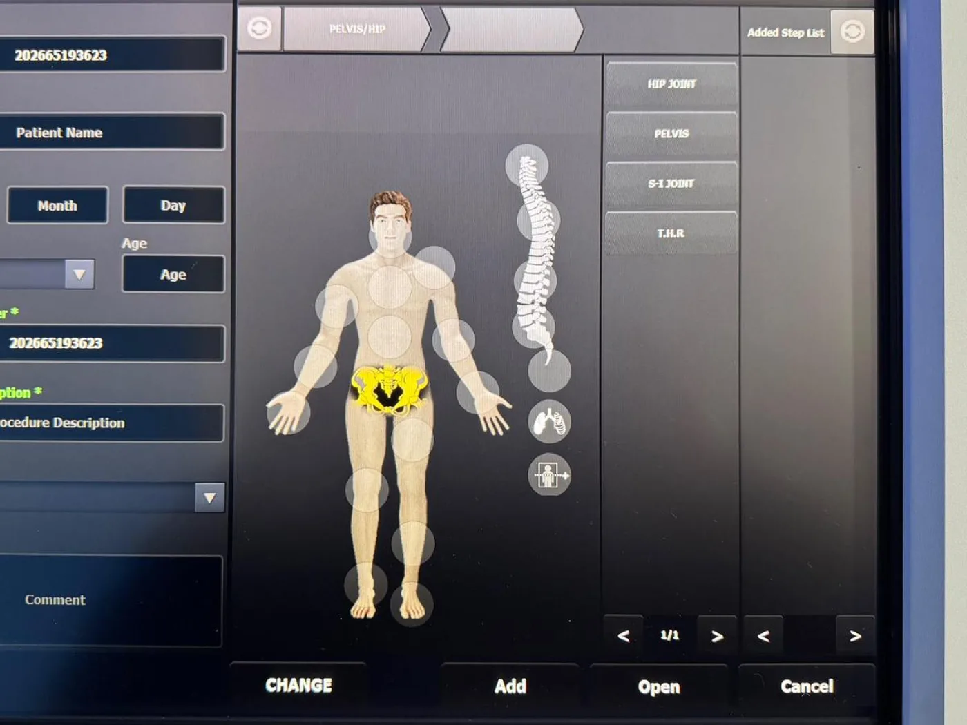 DRGEM TOPAZ-32D Mobile Xray with wireless detector 32kW 400mA YOM: 2020 - 8