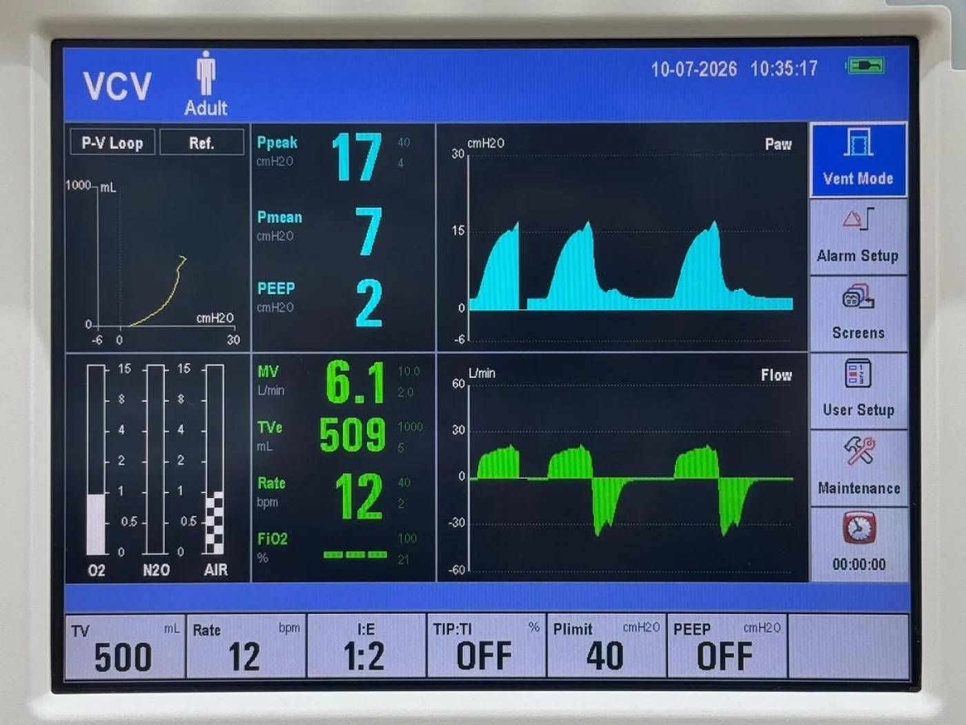 Mindray Wato EX-65 Anesthesia YOM: 2016 - 7