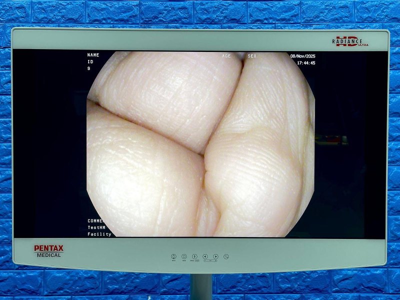 Pentax Scope Model: G-EYE38-i 10NL, Colonoscope, YOM: 2019, 25 Times Used.