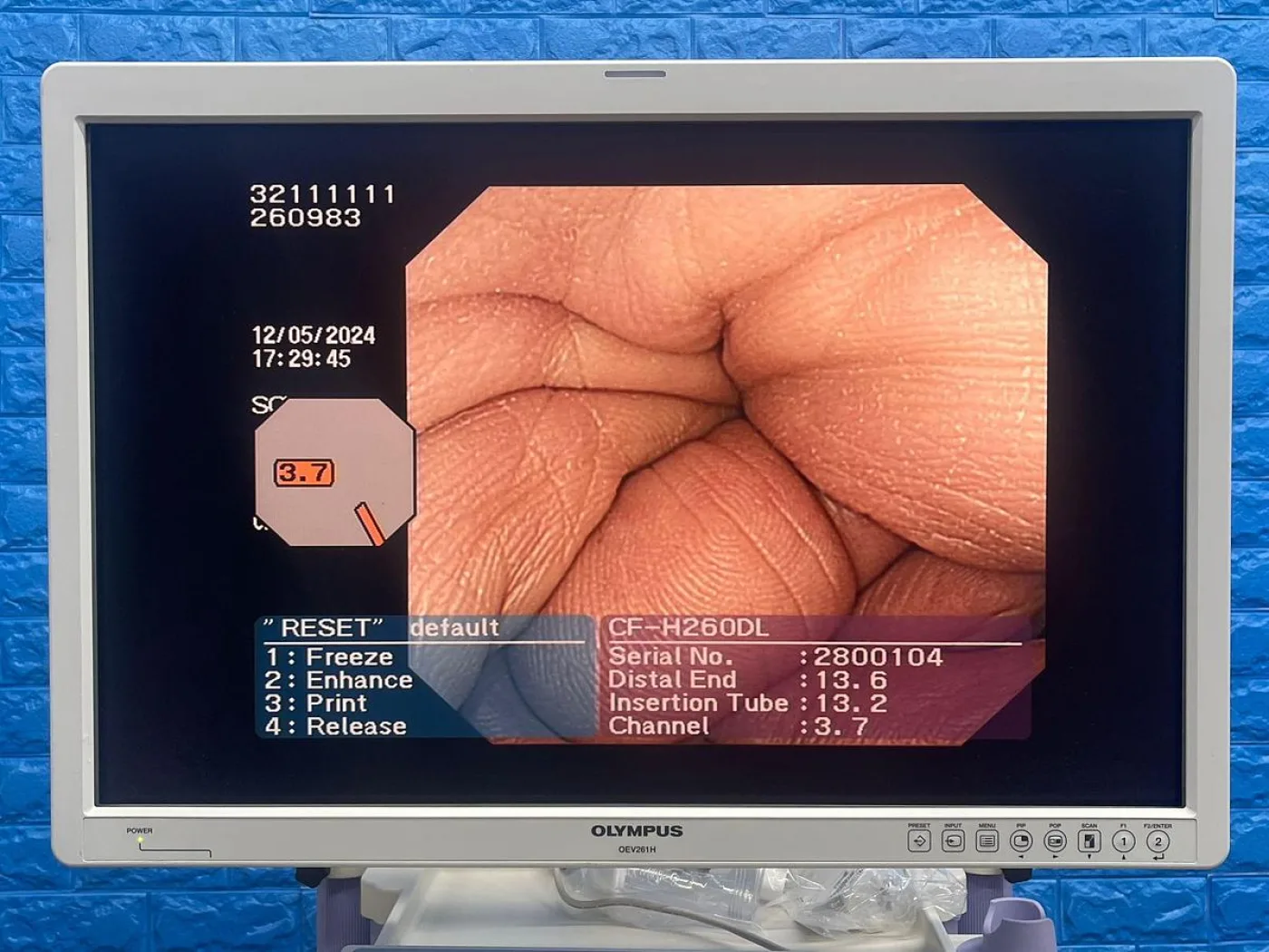 Olympus CF-H260DL Colonoscope - 1