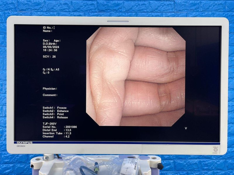 Olympus TJF 260V Duodenoscope