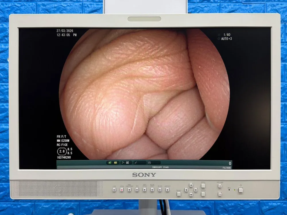 Fujinon Scope Model: EG-530FP Gastroscope